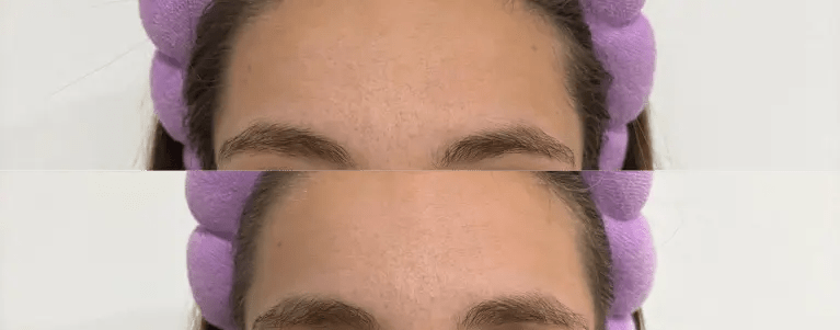 Silikonová náplast Nua – krk