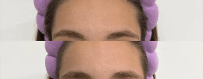 Silikonová náplast Nua – krk